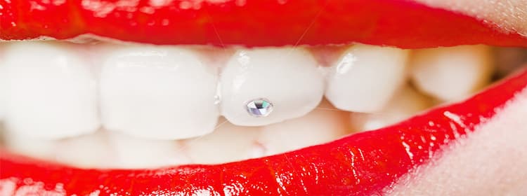 Dental Jewellery