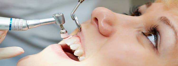 Oral Prophylaxis, Tooth Care