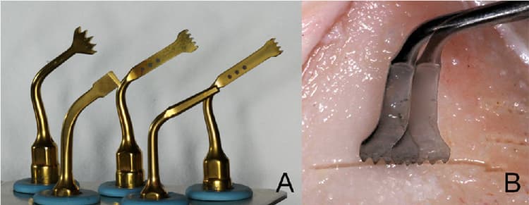 Piezoelectric Surgery