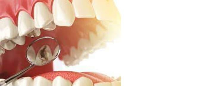 Treatment Of All Kinds Of Oral And Dental Diseases