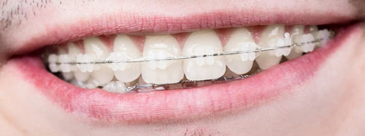 Treatment Of Uneven Tooth