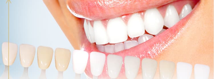 Whitening Of Teeth