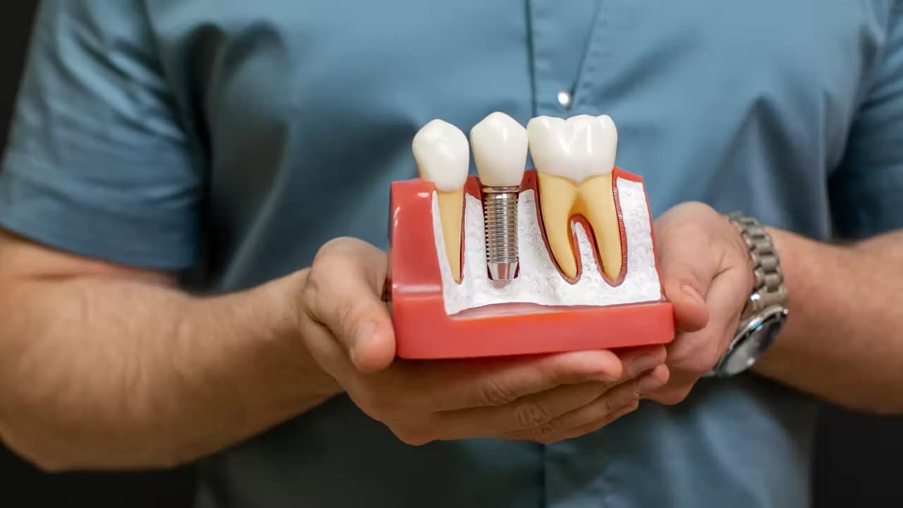 Dental Implant Recovery Tips