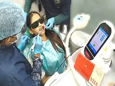 TEETH WHITENING BY LASER AND BLEACHING KIT AT DENTITY DENTAL IN KOLKATA