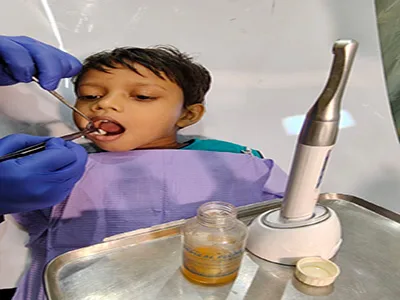CHILDREN'S DENTAL TREATMENT AT DENTITY DENTAL IN KOLKATA